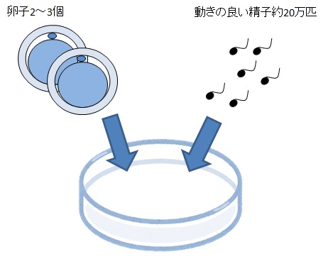 媒精の図