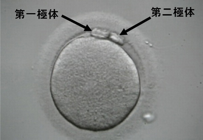 成熟卵の写真