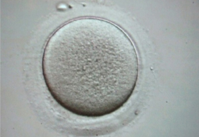 未熟卵の写真