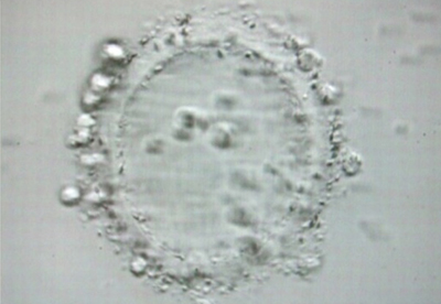 未熟卵の写真